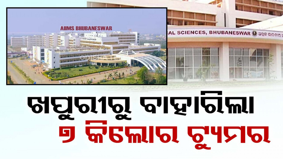 ଭୁବନେଶ୍ୱର AIIMSର ବଡ଼ ସଫଳତା, ଖପୁରୀରୁ ବାହାରିଲା ୭ କେଜିର ଟ୍ୟୁମର