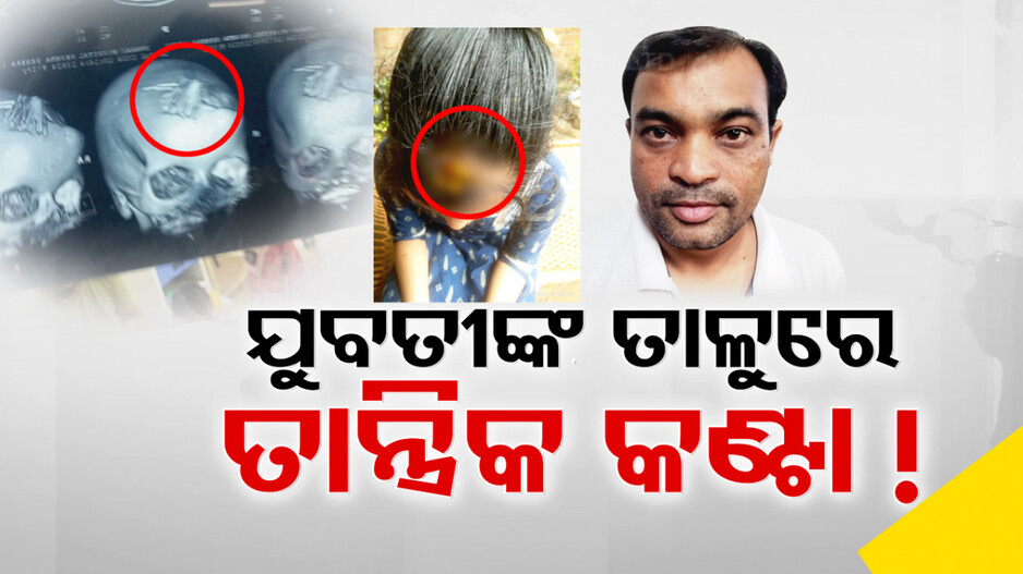 ଚିକିତ୍ସା ନାଁରେ ଯୁବତୀଙ୍କ ତାଳୁରେ ଫୋଡ଼ିଲା କଣ୍ଟା