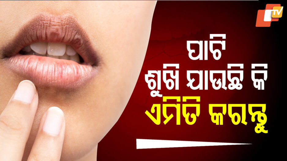 Dry Mouth: ଆପଣଙ୍କ ପାଟି ଶୁଖି ଅଠା ଅଠା ହୋଇଯାଉଛି କି ? କରନ୍ତୁ ନାହିଁ ଅଣଦେଖା