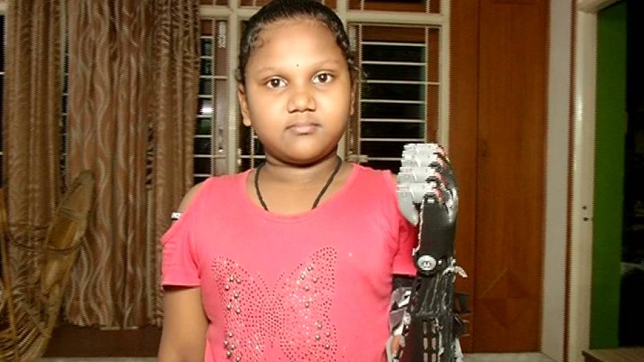 Odia Boy's Robotic Innovation Gives A New Lease Of Life To Divyang Girl