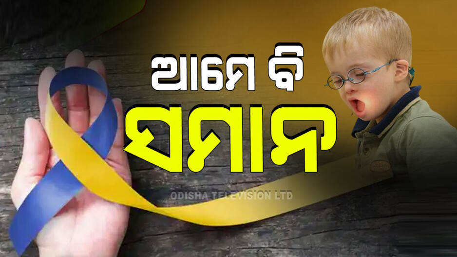 World Down Syndrome Day 2024: ଆସ ଏକ ହେବା, ଡାଉନ୍ ସିଣ୍ଡ୍ରୋମ ସହିତ ଜଡ଼ିତ ଭେଦଭାବ ବିରୋଧରେ ଲଢ଼ିବା