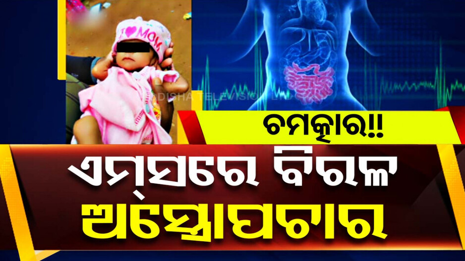 ରଖେ ହରି ତ ମାରେ କିଏ !! ଚିକିତ୍ସା ବିଜ୍ଞାନର ଚମତ୍କାରିତା ବଳରେ ନୂଆ ଜୀବନ ପାଇଲା କଅଁଳା ଶିଶୁ