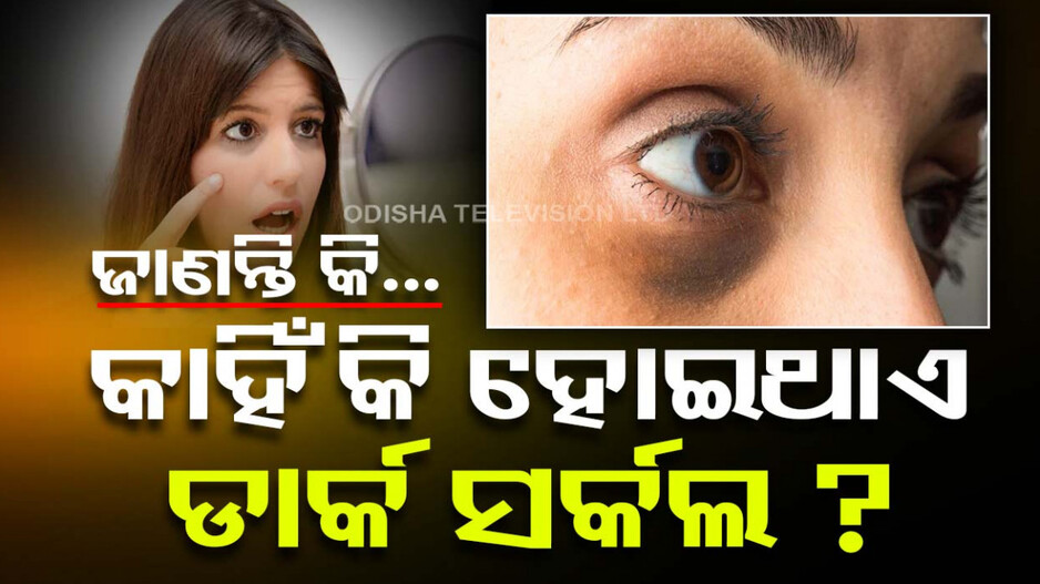 ଡାର୍କ ସର୍କଲ ପାଇଁ ଚିନ୍ତିତ କି ? ଜାଣନ୍ତୁ ତିନୋଟି ମୁଖ୍ୟ କାରଣ