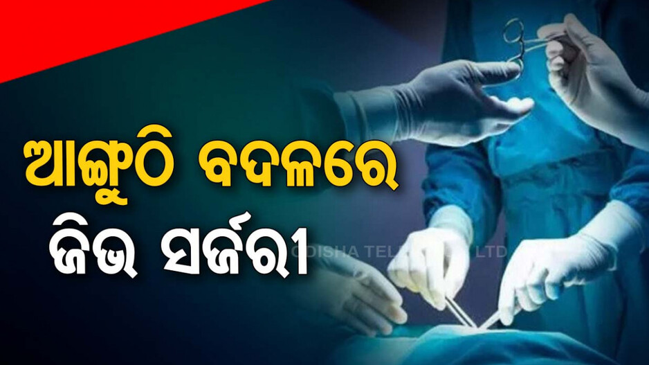 ଆଙ୍ଗୁଠି କାଟୁକାଟୁ କାଟିଦେଲେ ଜିଭ