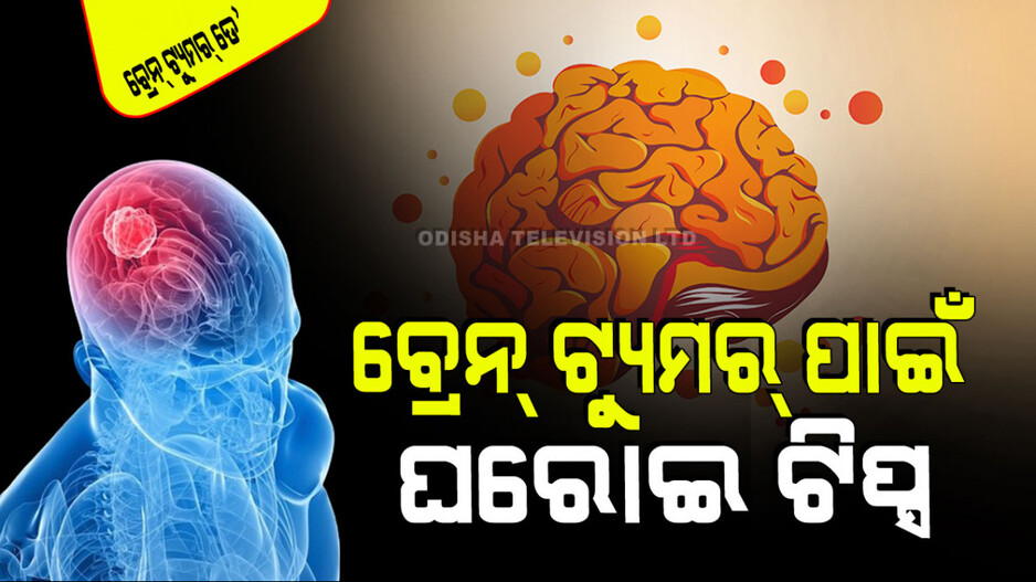 World Brain Tumor Day 2024: କିପରି ଜାଣିବେ ବ୍ରେନ୍ ଟ୍ୟୁମର୍; ଏଥିରୁ ମୁକୁଳିବାର ୪ଟି ଘରୋଇ ଉପାୟ