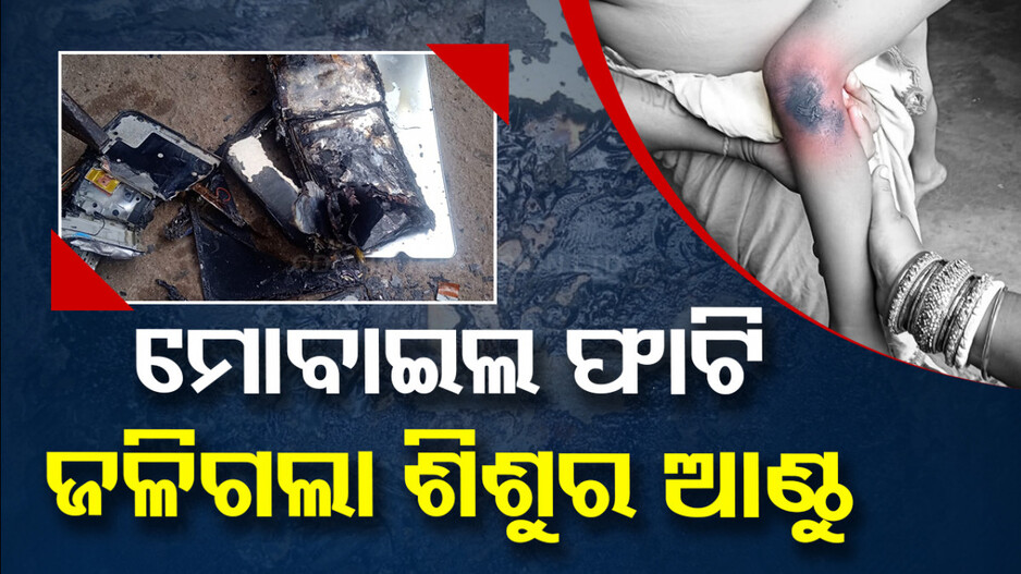 ରାତି ସାରା ବସାନ୍ତୁ ନାହିଁ ଚାର୍ଜ, ମୋବାଇଲ୍ ଫାଟି ଶିଶୁ ଗୁରୁତର...