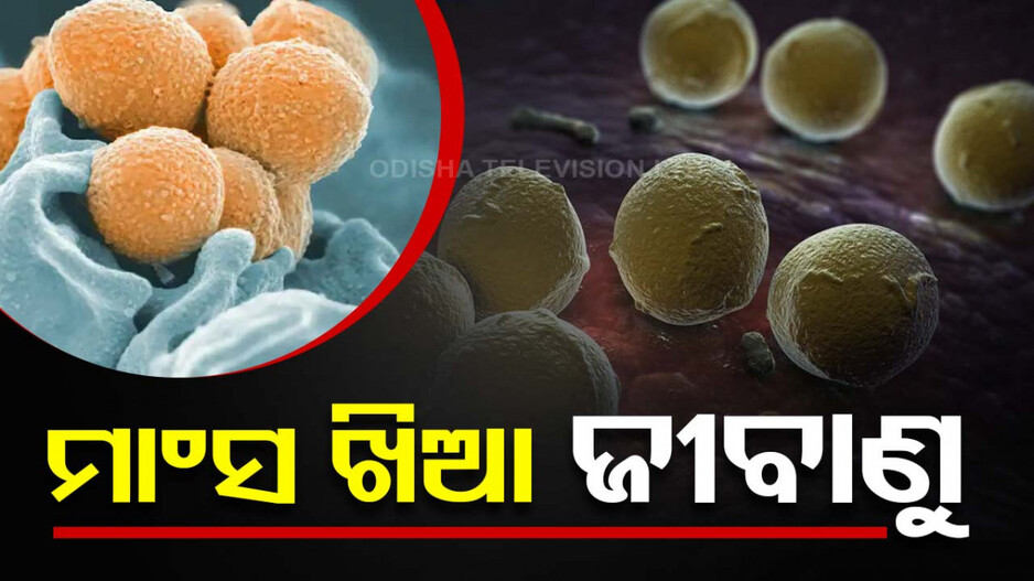 ଡରାଇଲାଣି ମାଂସ ଖିଆ ଜୀବାଣୁ, ୪୮ ଘଣ୍ଟାରେ ମଣିଷ ଜୀବନ ନେବାକୁ ସକ୍ଷମ