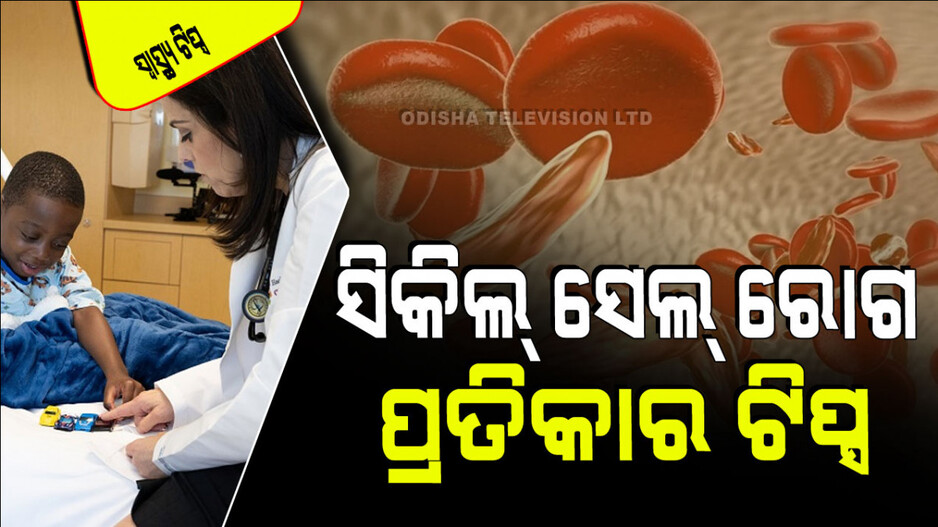 World Sickle Cell Awareness Day 2024: ସିକିଲ୍ ସେଲ୍ ରୋଗ କାହିଁକି ହୁଏ; ଜାଣନ୍ତୁ ଏହାର ପ୍ରତିରୋଧ ଉପାୟ