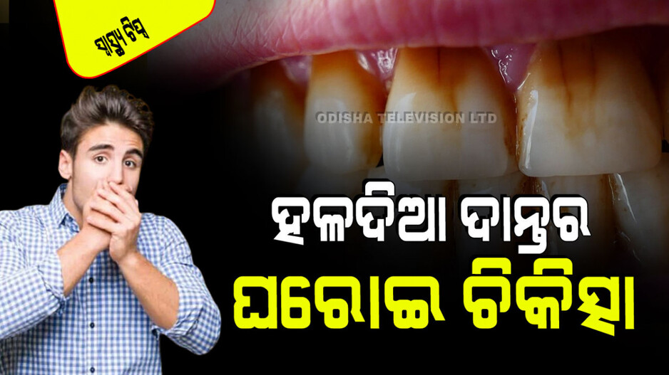 Health Tips: ଆପଣଙ୍କ ଦାନ୍ତ ହଳଦିଆ ପଡିଯାଉଛି କି… ଏହି ଘରୋଇ ଉପାୟରେ କରନ୍ତୁ ଚକ୍‌ଚକ୍