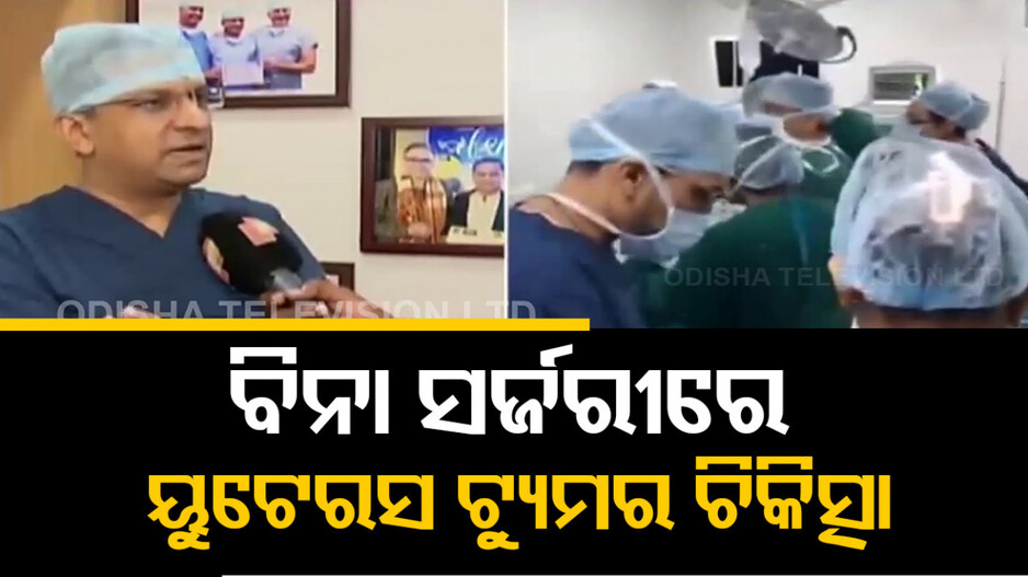 ବିନା ସର୍ଜରୀରେ ୟୁଟେରସ ଟ୍ୟୁମର ଚିକିତ୍ସା