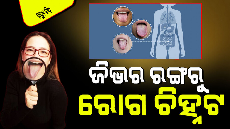 Health Tips: ଯିବାକୁ ପଡ଼ିବନି ଡାକ୍ତରଖାନା; ଜିଭର ରଙ୍ଗ ଦେଖି ଚିହ୍ନନ୍ତୁ ରୋଗ, ହୁଅନ୍ତୁ ସଚେତନ