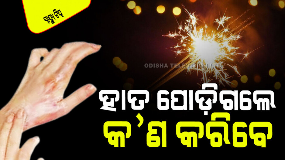 Diwali 2024: ବାଣ ଫୁଟାଇବା ବେଳେ ଯଦି ହାତ-ଗୋଡ ପୋଡିଯାଏ କ’ଣ କରିବେ… ୪ଟି ଟିପ୍ସ, ଦେବ ଆରାମ