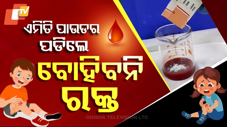Miracle in Medical Science: ରାଉରକେଲା NIT ଛାତ୍ରଙ୍କ କମାଲ୍, କଟିଥିଲେ କି ହାଡ଼ ଭାଙ୍ଗିଥିଲେ ଯୋଡ଼ିବ ବାୟୋଇଙ୍କ୍
