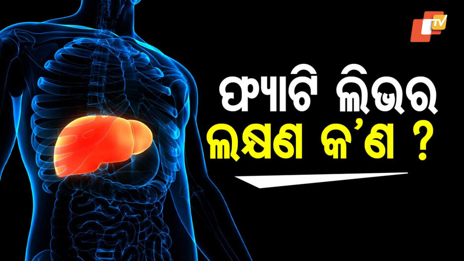 Fatty Liver: ଆଧୁନିକ ଜୀବନ ଶୈଳୀର ପରିଣାମ ହେଉଛି ଫ୍ୟାଟି-ଲିଭର୍, ଏଥିରୁ କେମିତି ମୁକୁଳିବେ ?