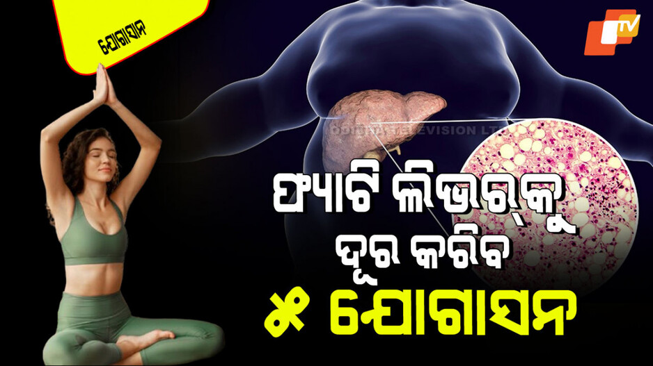 Yogasana: କରନ୍ତୁ ଏହି ୫ ସହଜ ଯୋଗାସନ; ଜୀବନରେ ହେବ ନାହିଁ ଫ୍ୟାଟି ଲିଭର୍‌ ଲିଭର