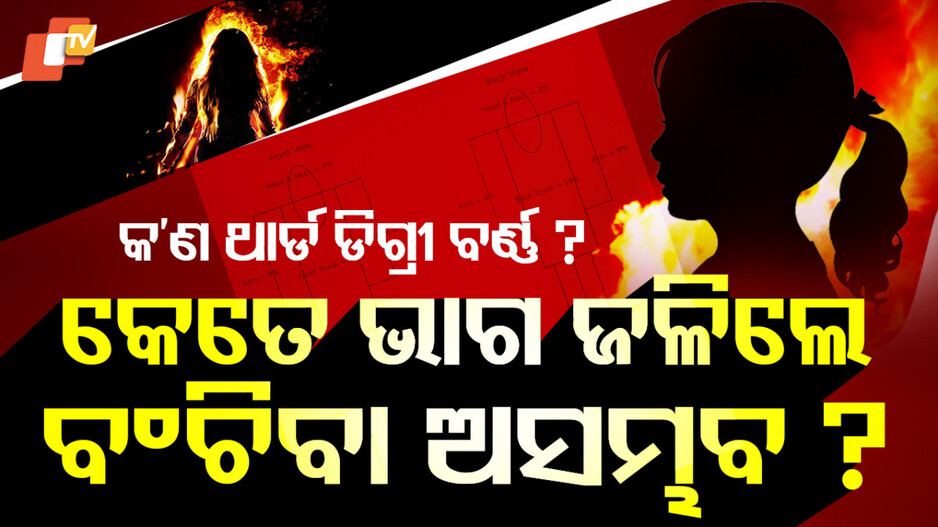 Burn: କେତେ ପ୍ରକାର ଜଳାପୋଡ଼ା, କେତେ ମାତ୍ରାରେ ଜଳିଲେ ମଣିଷର ମୃତ୍ୟୁ ହୋଇଥାଏ ଜାଣନ୍ତୁ