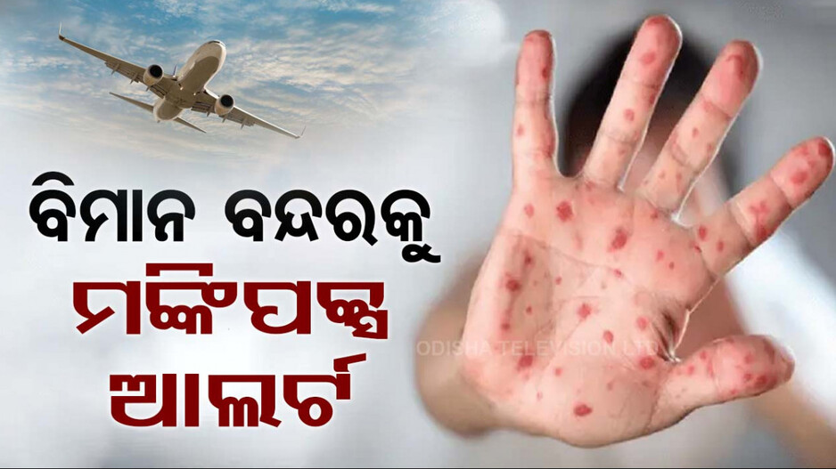 ଡରାଇଲାଣି ମଙ୍କିପକ୍ସ.. ସବୁ ବିମାନ ବନ୍ଦରକୁ ଆଲର୍ଟ, କେନ୍ଦ୍ର ସରକାରଙ୍କ ପକ୍ଷରୁ ସତର୍କତା ଜାରି