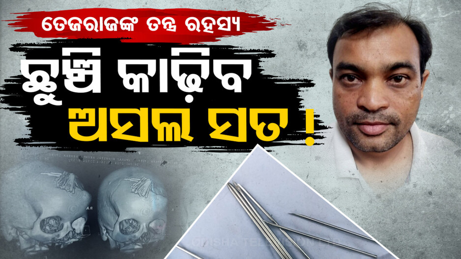 ତନ୍ତ୍ର କରି ମୁଣ୍ତରେ ପୁରାଇଥିଲେ ୯୦ ଛୁଞ୍ଚି, ବାହାରୁଛି ଗୋଟିଏ ପରେ ଗୋଟିଏ ସତ!