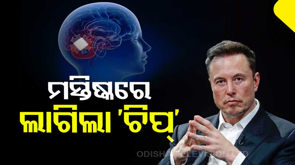 ମସ୍କଙ୍କ ‘ନ୍ୟୁରାଲିଙ୍କ୍‌’ କମ୍ପାନୀର ବଡ଼ ଉପଲବ୍ଧି, ପ୍ରଥମ ଥର ମାନବ ମସ୍ତିଷ୍କରେ ଲଗାଇଲା ‘ଚିପ୍‌’