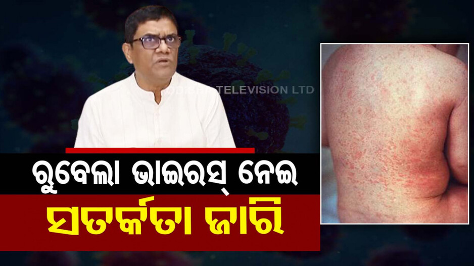 ରୁବେଲାକୁ ନେଇ ସ୍ୱାସ୍ଥ୍ୟ ନିର୍ଦ୍ଦେଶକଙ୍କ ସୂଚନା, ଗର୍ଭବତୀଙ୍କୁ ସତର୍କ ରହିବାକୁ ପରାମର୍ଶ
