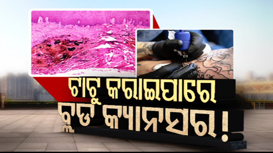 ଦେହରେ ଟାଟୁ କରୁଥିଲେ ସାବଧାନ; ହୋଇପାରେ ବ୍ଲଡ କ୍ୟାନସର !