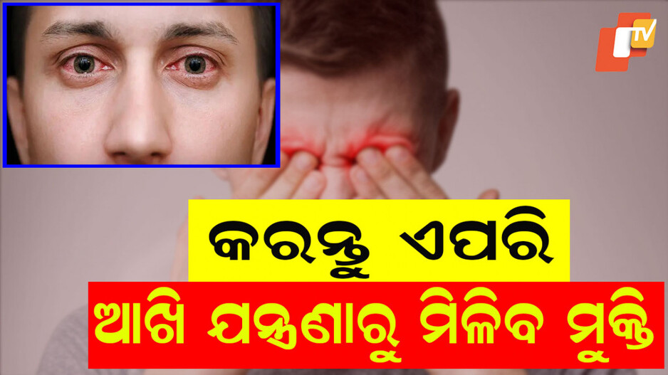 Why Eyes Burning: ଆଖି ପୋଡୁଛି, କୁଣ୍ଡାଇ ହେଉଛି ଓ ଝାପ୍ସା ଦେଖା ଯାଉଛି କି ? କ’ଣ କହୁଛନ୍ତି ଚକ୍ଷୁ ବିଶେଷଜ୍ଞ