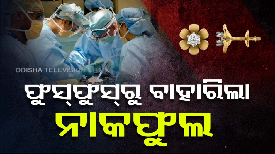 ନିଃଶ୍ୱାସ ନେବା ବେଳେ ଫୁସ୍‌ଫୁସ୍‌କୁ ଚାଲିଗଲା ନାକଫୁଲ; ଏମିତି ବାହାର କଲେ ଡାକ୍ତର