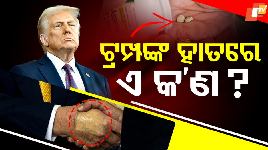 Donald Trump: ଡୋନାଲ୍ଡ ଟ୍ରମ୍ପଙ୍କ ହାତର ଏ କ’ଣ ହେଲା… ଫଟୋ ସୋସିଆଲ ମିଡିଆରେ ଭାଇରାଲ