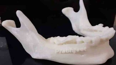 3D-printed-jaw