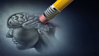 Alzheimer
