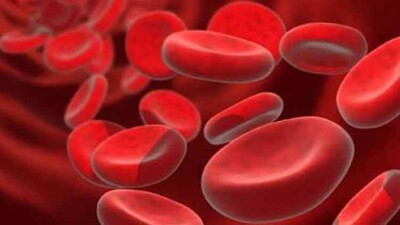 Anaemia