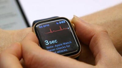 Apple-watch