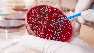 Blood-Cancer