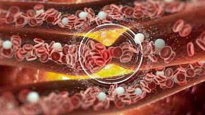 Blood Clotting