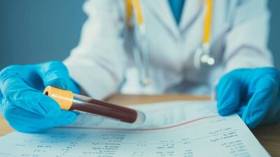 Blood-Test