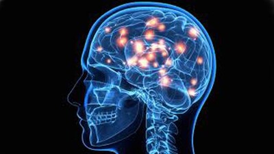 Brain-Health