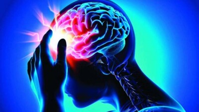 Brain-Stroke