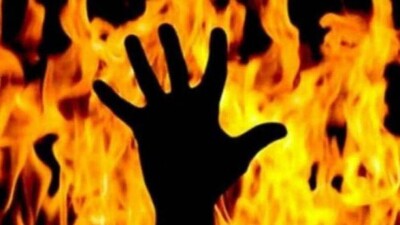 Burnt-Alive