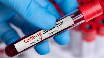 Coronavirus