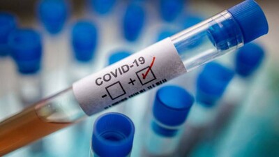 COVID-19-Test-Positive
