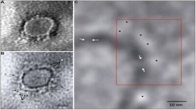 COVID-19-Virus