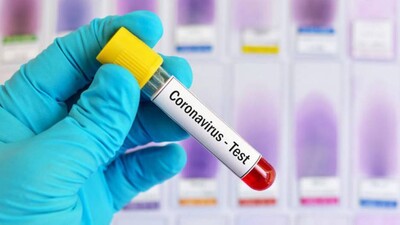 Covid-19 Odisha Update