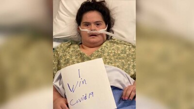 Down Syndrome Associated With Increased Risk Of Covid-19-Related Death