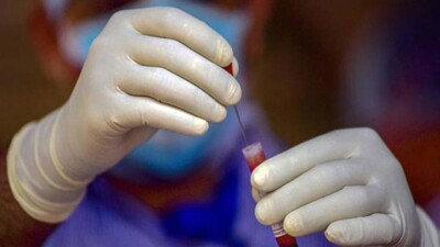COVID19-Vaccine
