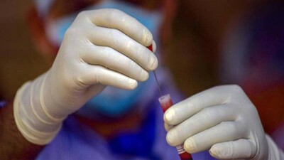 COVID19 Vaccine