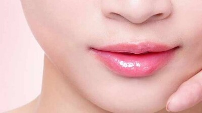 Chapped-lips