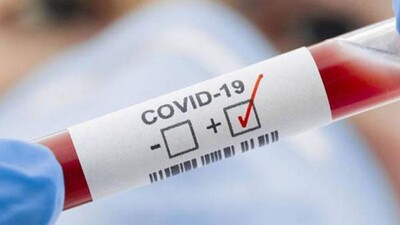 Covid-19 cases in India