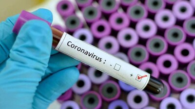 Coronavirus-1