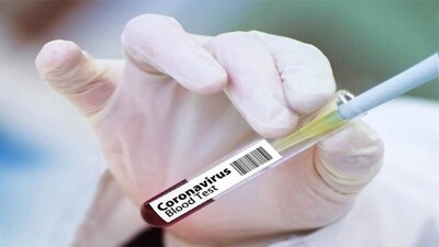 Coronavirus