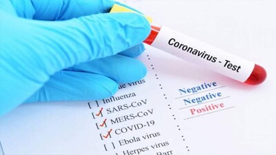 Coronavirus
